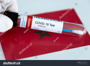 Tests for the presence of coronavirus in Morocco. Tube containing a collection sample that has tested positive for COVID-19.